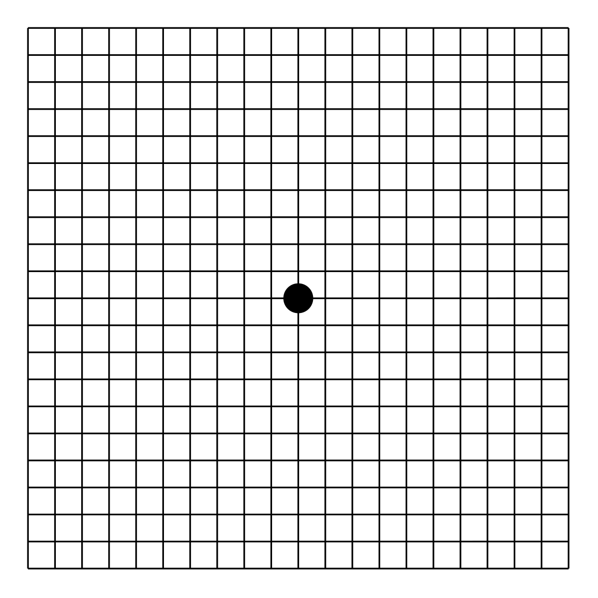 An Amsler grid: a square of evenly spaced lines with a dot in the centre